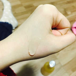 퓨어힐스 카렌듈라 90 블레미쉬 솔루션 — 3.5점을 준 리뷰어가 2017년 3월 올린 사용 사진