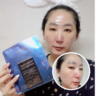 셀더마 마린 콜라겐 하이드로겔 마스크팩 5박스 — 5점을 준 리뷰어가 2020년 3월 올린 사용 사진