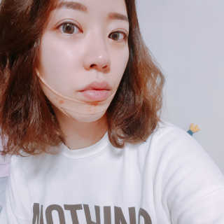 아이디플라코스메틱 아이디 페이스핏 마이너스 밴드 — 5점을 준 리뷰어가 2019년 12월 올린 사용 사진