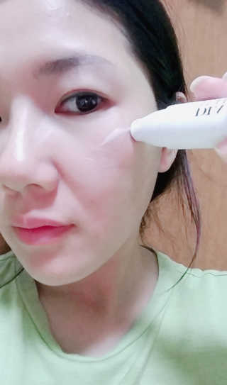 쏘내추럴 화이트닝 스팟 코렉터 — 3.5점을 준 리뷰어가 2019년 9월 올린 사용 사진