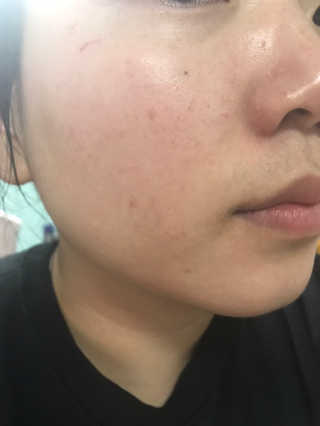 비건화장품 멜릭서 내 피부를 위한 비건케어, 멜릭서 비타민세럼 — 4점을 준 리뷰어가 2019년 3월 올린 사용 사진