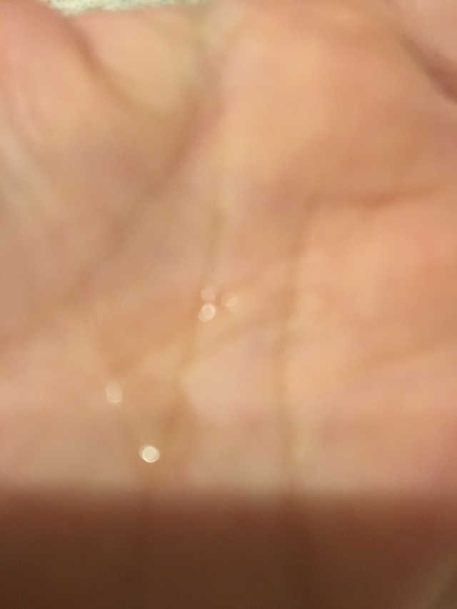 [마녀 공장] 발가락 토미 니아신 에센스 50ml 리뷰 사진
