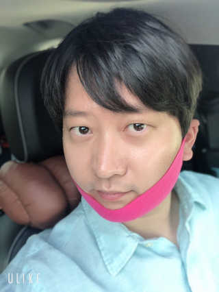 스케덤 펩타이드 리프팅밴드 — 4점을 준 리뷰어가 2019년 5월 올린 사용 사진