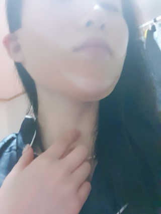 아이디플라코스메틱 아이디 페이스핏 마이너스 밴드 — 5점을 준 리뷰어가 2020년 1월 올린 사용 사진