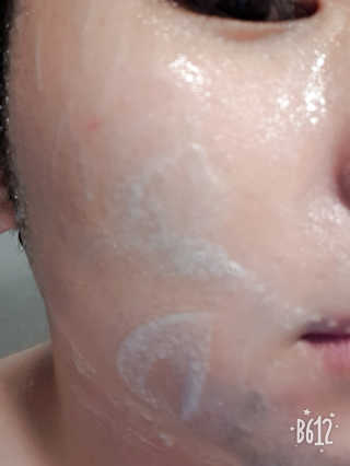 페어아크네 크리미폼 페어아크네 크리미 폼 — 4점을 준 리뷰어가 2019년 8월 올린 사용 사진