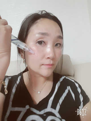 23years old 바데카실 프로 엑스퍼트 앰플 — 5점을 준 리뷰어가 2018년 7월 올린 사용 사진