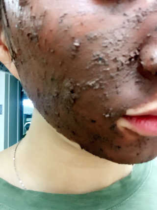 글랜무어 포어 포졸라닉 타이트닝 팩 — 5점을 준 리뷰어가 2017년 7월 올린 사용 사진