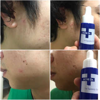 so님이 올린 리뷰 사진 2