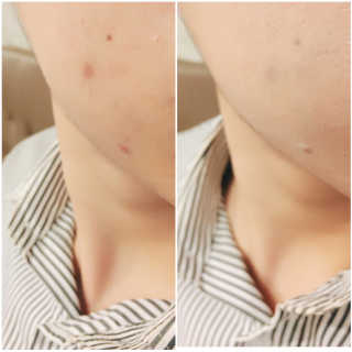 채호영님이 올린 리뷰 사진 3