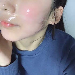 더메이블 라벤더 스킨 릴리프 하이드로겔 마스크 — 5점을 준 리뷰어가 2018년 12월 올린 사용 사진