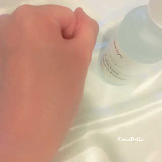 [마녀 공장] 발가락 토미 니아신 에센스 50ml — 5점을 준 리뷰어가 2019년 3월 올린 사용 사진