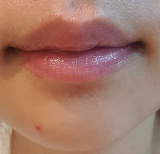[후르디아] 블루베리 과즙 듬뿍 꿀과즙립밤 3개 세트 — 4점을 준 리뷰어가 2019년 11월 올린 사용 사진