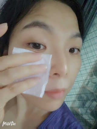 [헬로아이즈] 아이더마덱스 100ml + 순면솜120매 — 5점을 준 리뷰어가 2020년 8월 올린 사용 사진