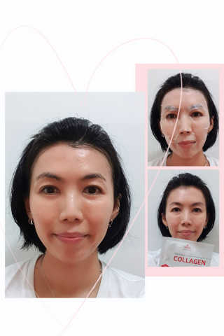 트리티스 [Treatis] Facial Sheet Mask — 5점을 준 리뷰어가 2021년 1월 올린 사용 사진