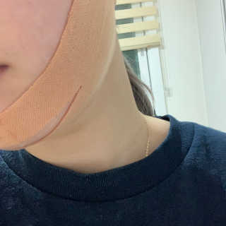 아이디플라코스메틱 아이디 페이스핏 마이너스 밴드 — 4점을 준 리뷰어가 2020년 4월 올린 사용 사진