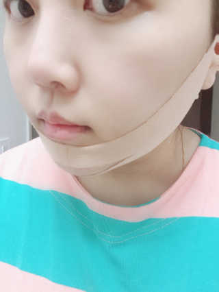 아이디플라코스메틱 아이디 페이스핏 마이너스 밴드 — 5점을 준 리뷰어가 2020년 4월 올린 사용 사진