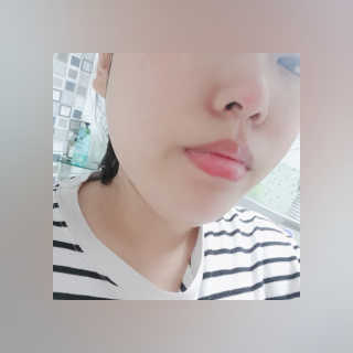 메디필 에스테 더마 유산균 콜라겐 클리어 — 5점을 준 리뷰어가 2020년 7월 올린 사용 사진