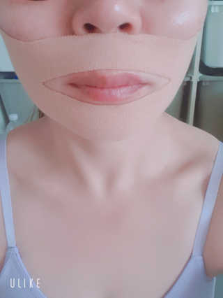 아이디플라코스메틱 아이디 페이스핏 마이너스 밴드 — 5점을 준 리뷰어가 2020년 4월 올린 사용 사진