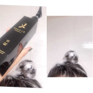 [두피헤어 트리트먼트] 케이원큐어 스켈프 젤 270ml — 4.5점을 준 리뷰어가 2020년 9월 올린 사용 사진