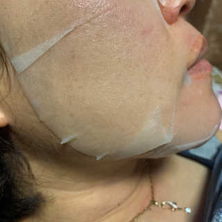 리더스코스메틱 리더스 시카 카밍  마스크 — 5점을 준 리뷰어가 2020년 6월 올린 사용 사진