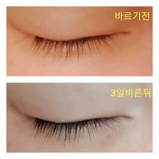 뷰티움얼티밋아이래쉬그로스세럼 — 5점을 준 리뷰어가 2020년 5월 올린 사용 사진