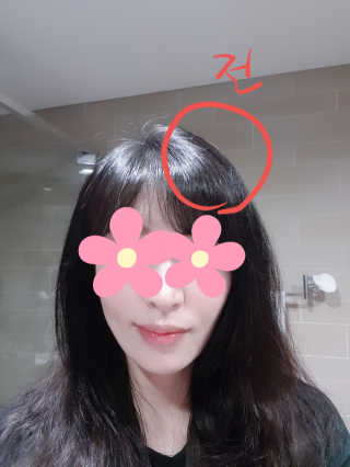 다슈코리아 다슈 데일리 탈모완화 초강력 헤어 스프레이 — 5점을 준 리뷰어가 2020년 7월 올린 사용 사진