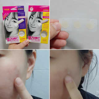 엘라밴드 하이드로 도트 스팟패치 12mm, 10mm — 5점을 준 리뷰어가 2020년 9월 올린 사용 사진