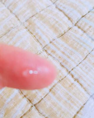 derma SC-Gel 더마에스씨 겔 20g — 5점을 준 리뷰어가 2020년 5월 올린 사용 사진