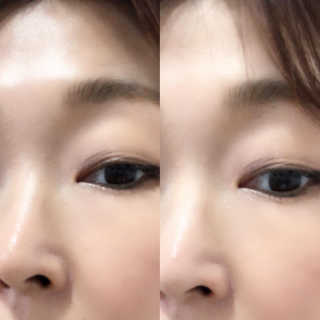 본다움 빠이빠이 세범 파우더 — 5점을 준 리뷰어가 2020년 7월 올린 사용 사진