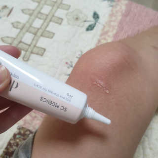 derma SC-Gel 더마에스씨 겔 20g — 4점을 준 리뷰어가 2020년 5월 올린 사용 사진