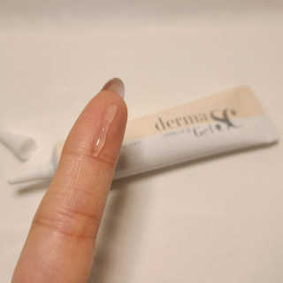 derma SC-Gel 더마에스씨 겔 20g — 4.5점을 준 리뷰어가 2020년 5월 올린 사용 사진