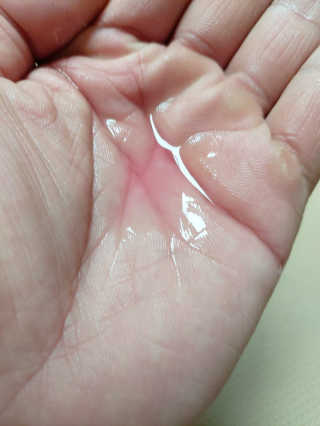 어글리프루프 에센스 스탑디어글리 레드모먼트 에센스 120ml — 5점을 준 리뷰어가 2020년 10월 올린 사용 사진
