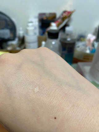 derma SC-Gel 더마에스씨 겔 20g — 4점을 준 리뷰어가 2020년 4월 올린 사용 사진