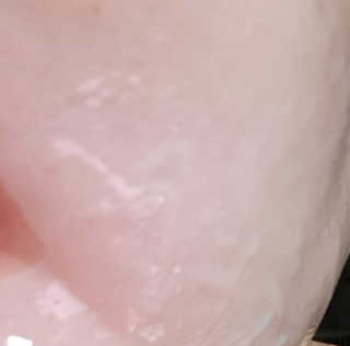 이너풀 하이 모이스처라이징 바이오셀룰로오스 마스크 — 1점을 준 리뷰어가 2020년 9월 올린 사용 사진