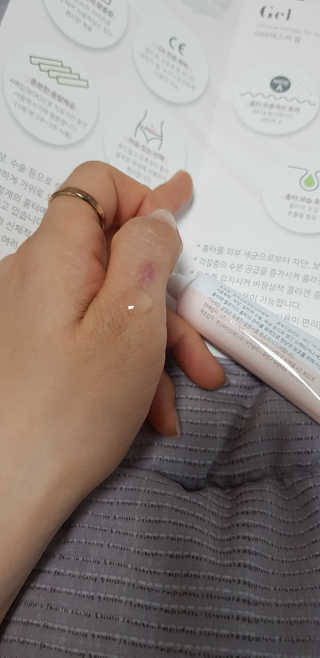 derma SC-Gel 더마에스씨 겔 20g — 4점을 준 리뷰어가 2020년 5월 올린 사용 사진