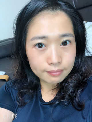 바베 BABE 바베 프로테오글리칸 F+F 앰플 솔루션 — 4점을 준 리뷰어가 2020년 8월 올린 사용 사진
