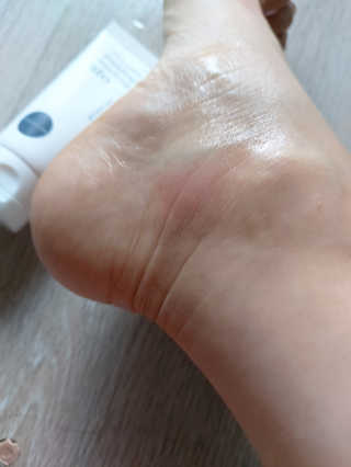 냉장고에 넣어요, 붉은 트러블 피부 다음날 진정되요 [버진팜스 푸딩수딩아토] — 5점을 준 리뷰어가 2020년 9월 올린 사용 사진
