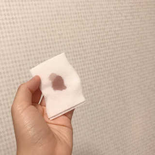 메디필 블랙 허니 세범 익스트렉터 — 4점을 준 리뷰어가 2020년 6월 올린 사용 사진
