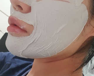 아이디플라코스메틱 페이스핏 플라스터 마스크 _ 리뉴얼 — 5점을 준 리뷰어가 2020년 12월 올린 사용 사진