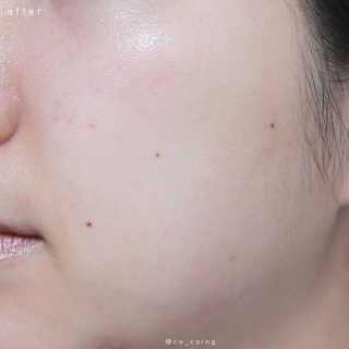 ilonzz님이 올린 리뷰 사진 3