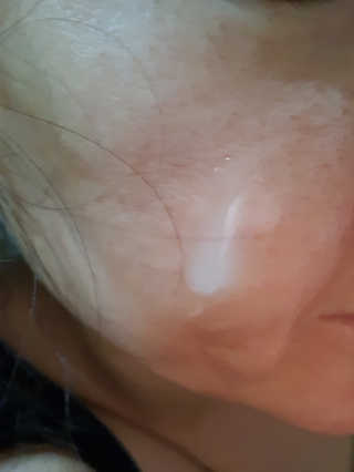냉장고에 넣어요, 붉은 트러블 피부 다음날 진정되요 [버진팜스 푸딩수딩아토] — 5점을 준 리뷰어가 2020년 9월 올린 사용 사진
