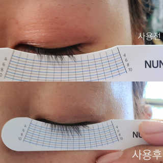 닥터존스킨 눈썹자라 — 5점을 준 리뷰어가 2020년 8월 올린 사용 사진