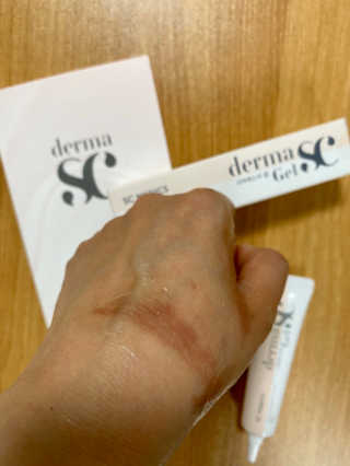 derma SC-Gel 더마에스씨 겔 20g — 5점을 준 리뷰어가 2020년 5월 올린 사용 사진