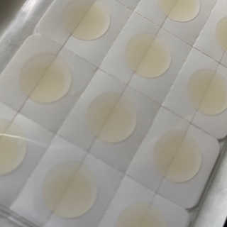 엘라밴드 하이드로 도트 스팟패치 12mm, 10mm — 5점을 준 리뷰어가 2020년 8월 올린 사용 사진