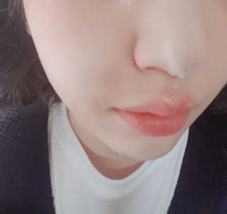 자이엘 S.O.S 레드 칙 케어팩 2 Box — 4점을 준 리뷰어가 2020년 4월 올린 사용 사진
