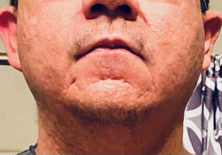 아 바자르 퍼펙트 브이 리프팅 프리미엄 우먼 마스크 — 5점을 준 리뷰어가 2020년 12월 올린 사용 사진