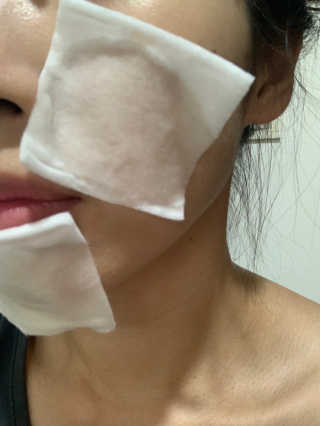파머스시그니처 어성초, 작약뿌리, 흑미 추출물 3종 — 5점을 준 리뷰어가 2020년 9월 올린 사용 사진