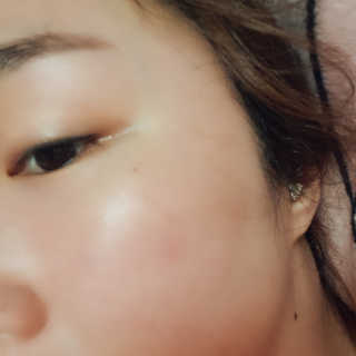 이너풀 하이 모이스처라이징 바이오셀룰로오스 마스크 — 5점을 준 리뷰어가 2020년 8월 올린 사용 사진