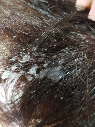달리프 글램 헤어팩 인미스트 200ml — 5점을 준 리뷰어가 2020년 8월 올린 사용 사진