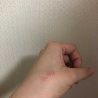 어글리프루프 에센스 스탑디어글리 레드모먼트 에센스 120ml — 4점을 준 리뷰어가 2020년 7월 올린 사용 사진